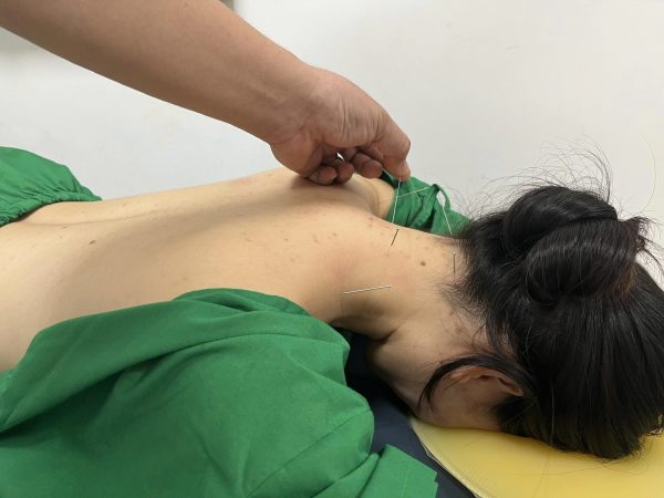 Điều trị Cơ Xương Khớp bằng Y học cổ truyền an toàn và ít tác dụng phụ